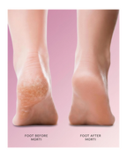Morti™ Heel Fixer