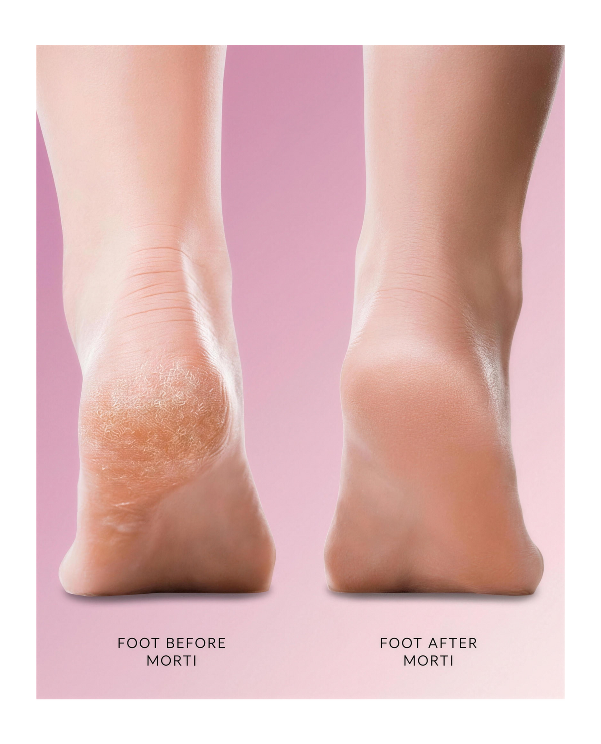Morti™ Heel Fixer